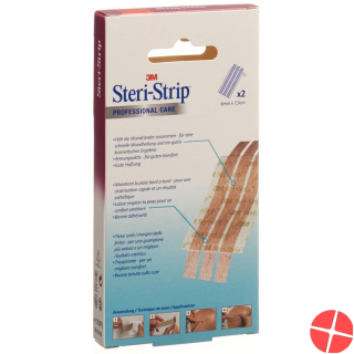 3M Steri Strip Elastisch 6x75mm Beige 2x 3 Stück