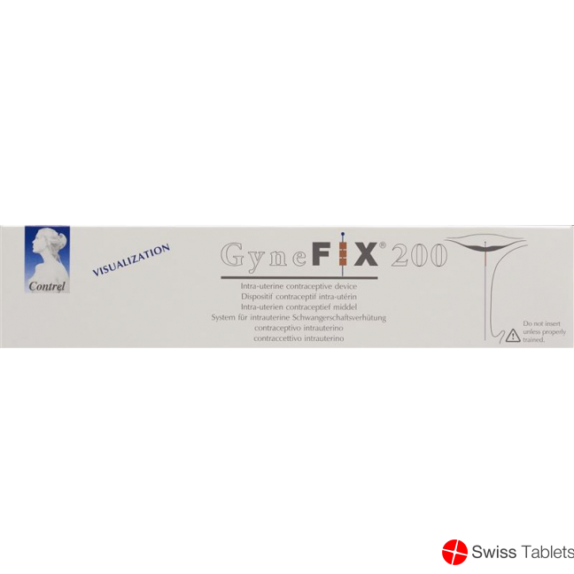 GyneFix 200 IUD