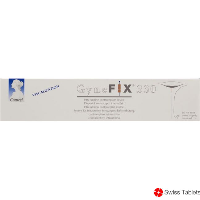 GyneFix 330 IUD