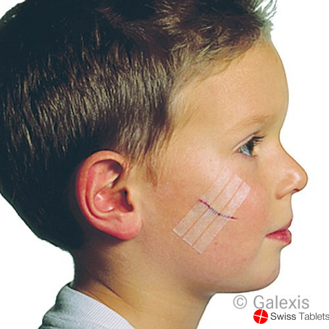 3M Steri Strip Elastisch 6x75mm Naturfarben 3x 50 Stück buy online